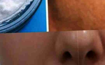 Baking soda can help get rid of age spots, acne, and blackheads! This is what you should do