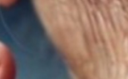 Use Castor Oil, but NEVER Make These 12 Mistakes