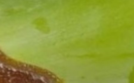 1000 Times Stronger Than Botox! Natural Collagen Aloe Vera! Erases All Wrinkles