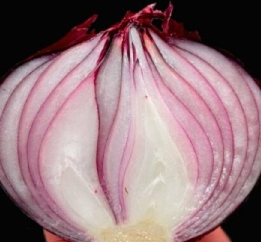 Erases Varicose Veins Like an Eraser! Top 5 Recipes with Red Onion