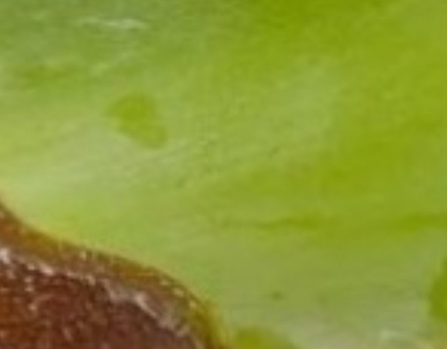 1000 Times Stronger Than Botox! Natural Collagen Aloe Vera! Erases All Wrinkles