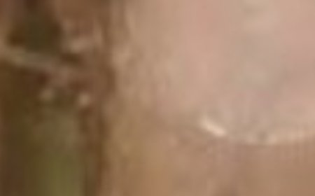 Soaked My Feet in Apple Cider Vinegar and 15 Minutes Later I Was Shocked at What Happened! (Did You Know That?)