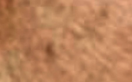 Shocking She Wiped the Dark Spots Off Her Face with Potatoes and Ginger in Just 20 Minutes