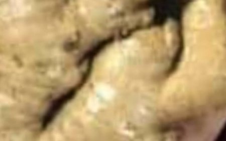 Boost Your Health with Ginger and Lime