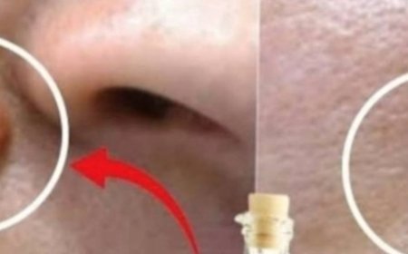 Apple Cider Vinegar: A Natural Solution for Removing Warts in 24 Hours