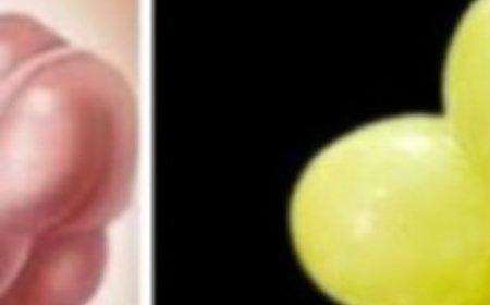 Intestine and Liver Are Like New! Just 3 Days with Grapes – All the Dirt Comes Out