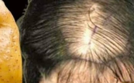 Hair Grows Like Crazy and Doesn’t Fall Out! Discover the Powerful Potato Recipe