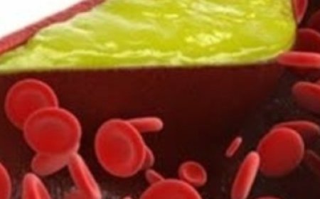 Take 1 Spoon Daily and Clean Your Blood Vessels, Prevent Heart Attack and Stroke! Cinnamon