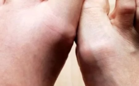 No. 1 Vitamin for Removing Swelling from the Body: Vitamin C