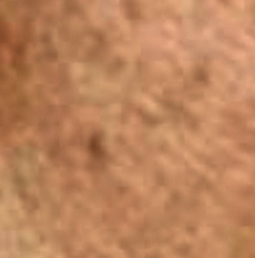 Shocking She Wiped the Dark Spots Off Her Face with Potatoes and Ginger in Just 20 Minutes