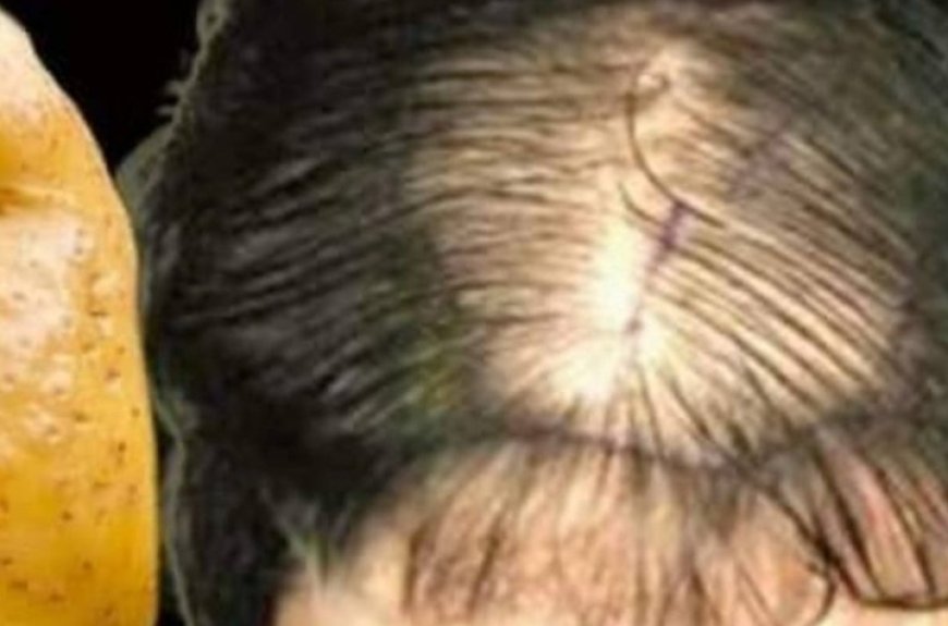 Hair Grows Like Crazy and Doesn’t Fall Out! Discover the Powerful Potato Recipe