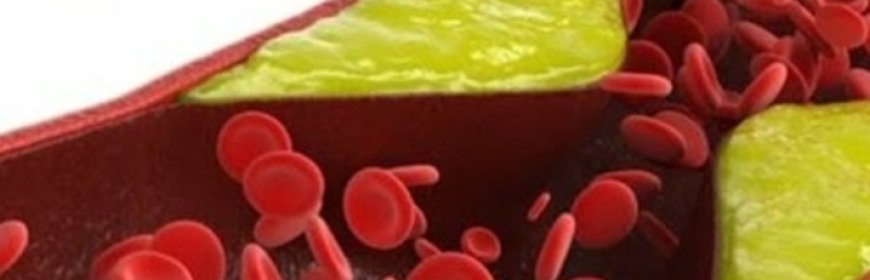 Take 1 Spoon Daily and Clean Your Blood Vessels, Prevent Heart Attack and Stroke! Cinnamon