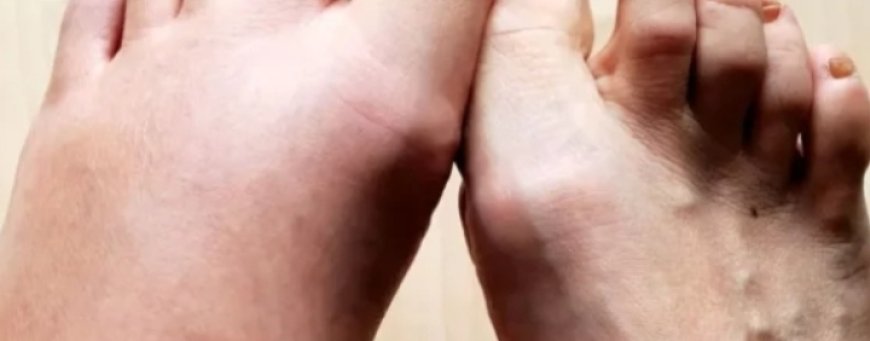 No. 1 Vitamin for Removing Swelling from the Body: Vitamin C