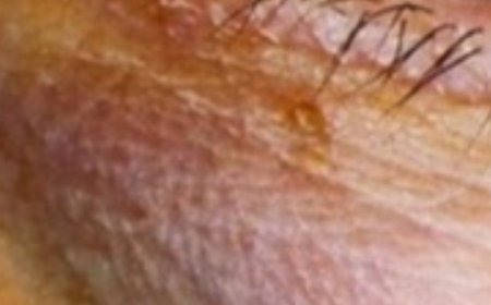 10 Signs You Might Be Consuming Too Much Sugar