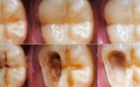 Natural Ways to Maintain Good Dental Health