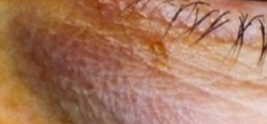 10 Signs You Might Be Consuming Too Much Sugar