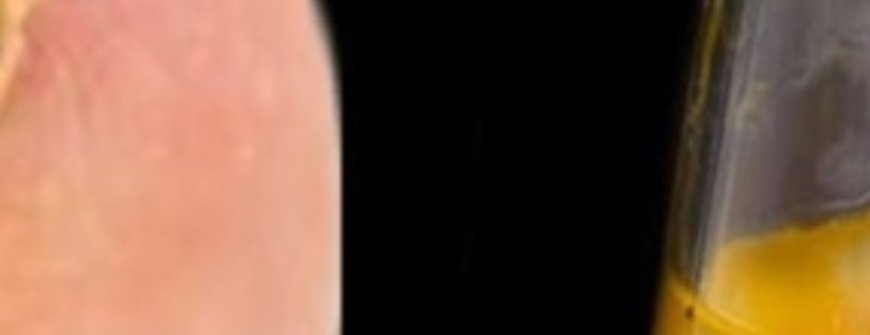 A Simple and Effective Natural Remedy for Nail Fungus