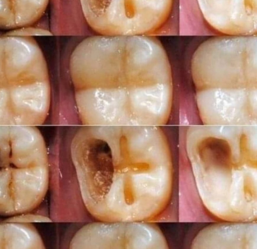 Natural Ways to Maintain Good Dental Health