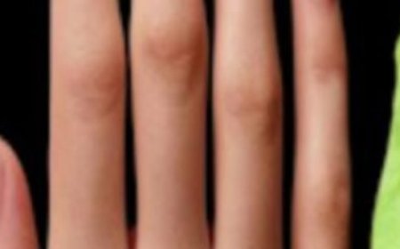 The Secret of Cabbage Leaves A Natural Remedy