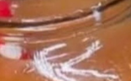 This recipe combines ingredients that may help soothe the throat and support respiratory health. Here’s how to prepare it: