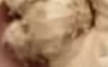 Teeth whitening in 2 minutes