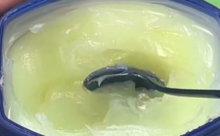 Few People Know What Vaseline Does: Life Hacks with Vaseline