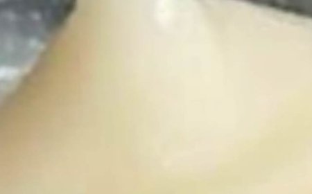 Facelift with Natural Collagen! At 65, Wrinkles Disappear in 3 Minutes with Rice Water!