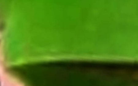 Aloe Vera: A Natural Remedy for Nail Fungus