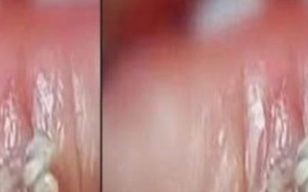 BE VERY CAREFUL . If you get this, you are infected with