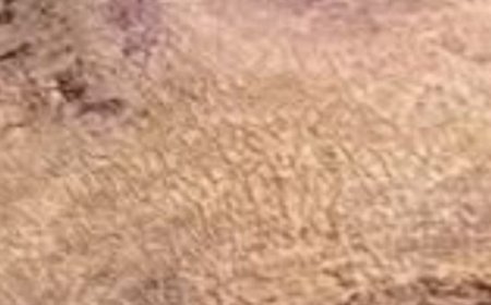 Suffering from Inflamed Kidneys? Cleanse and Purify Them with Just Two Ingredients