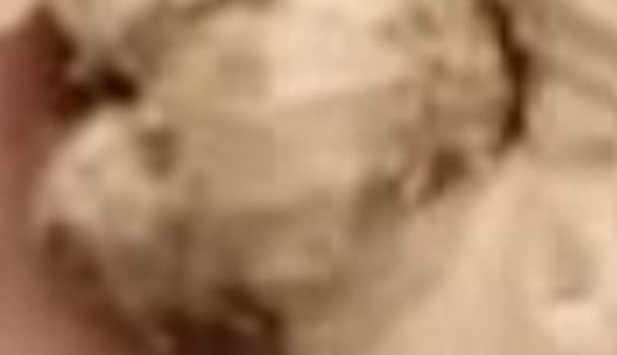 Teeth whitening in 2 minutes