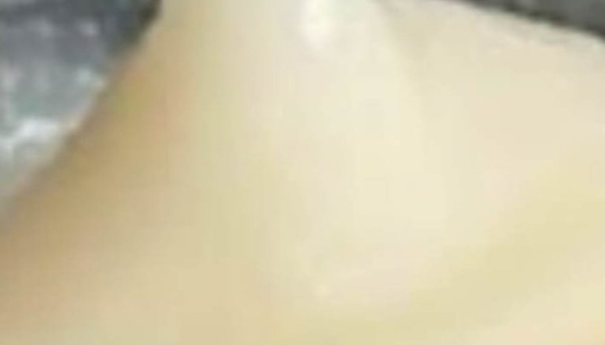 Facelift with Natural Collagen! At 65, Wrinkles Disappear in 3 Minutes with Rice Water!