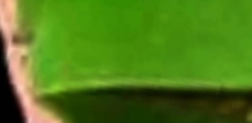 Aloe Vera: A Natural Remedy for Nail Fungus