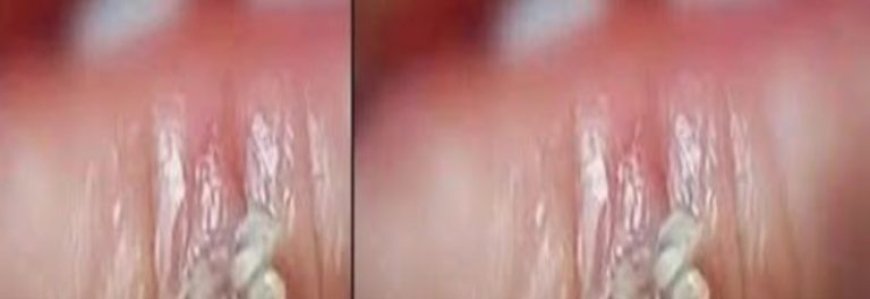 BE VERY CAREFUL . If you get this, you are infected with