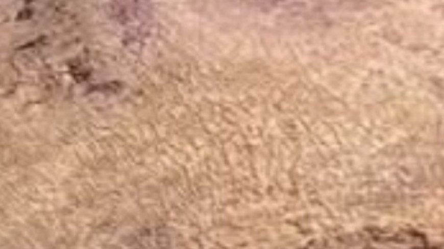 Suffering from Inflamed Kidneys? Cleanse and Purify Them with Just Two Ingredients