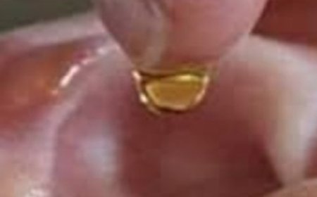 Put 2 drops in your ear and you will hear like before. Recover your hearing.