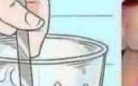 Remove tartar from your teeth and whiten them with thi