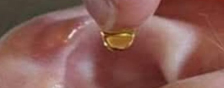 Put 2 drops in your ear and you will hear like before. Recover your hearing.