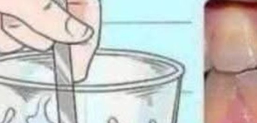 Remove tartar from your teeth and whiten them with thi