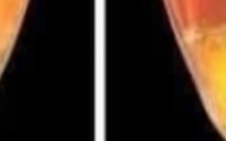 Peeing in the Shower, Doctor Explains Why Women Shouldn’t