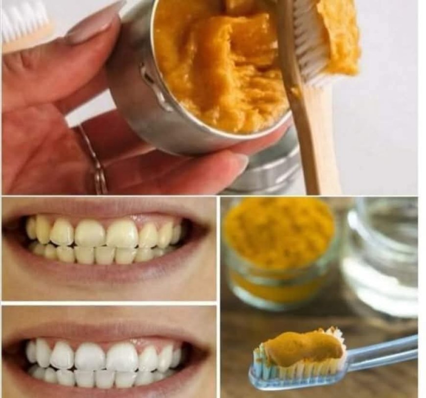 Discover the Natural Wonder of Turmeric for Dental Healt