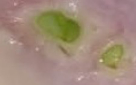 Onion Cooked in Milk: An Unmatched Natural Remedy