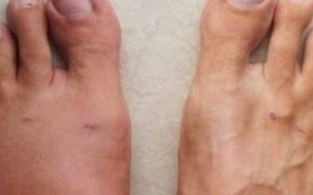 One month before a heart att.ack, your body will send you of these 6 signs. Pay attention to the 6th