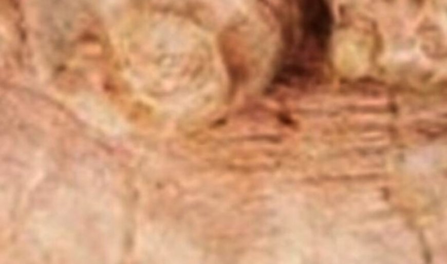 Ginger: A Natural Alternative to Botox for Wrinkle Reduction