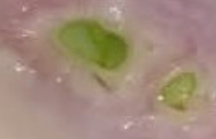 Onion Cooked in Milk: An Unmatched Natural Remedy