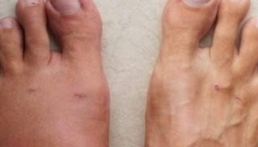 One month before a heart att.ack, your body will send you of these 6 signs. Pay attention to the 6th