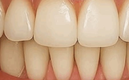 Grandma’s Secret To A Brighter Smile: Guava Leaves For Natural Oral Care