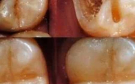 Natural Ways to Maintain Good Dental Health