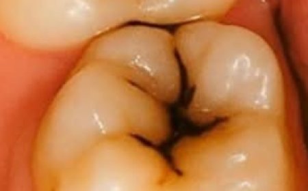 Natural Ways to Protect and Repair Your Teeth