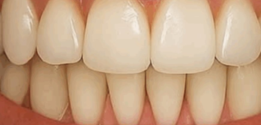 Grandma’s Secret To A Brighter Smile: Guava Leaves For Natural Oral Care